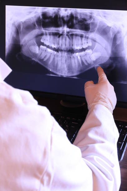 Best Emergency Dental Care for Abscessed Tooth in West Brownsville, PA